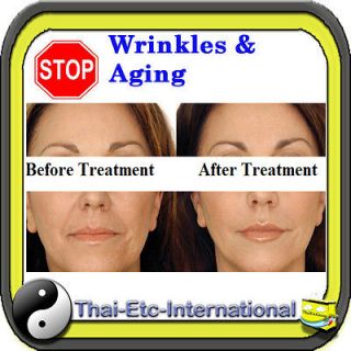 20g STRONG RETINOL VITAMIN A CREAM Retin ol Acne Anti wrinkles Blemish 