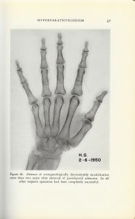 RARE Metabolic Bone Disease 1952 Isidore Snapper