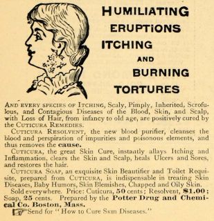 1885 Ad Potter Drug Chemical Cuticura Cures Itch Burn   ORIGINAL